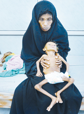 صلیب سرخ: یمن از گرسنگی در حال مرگ است