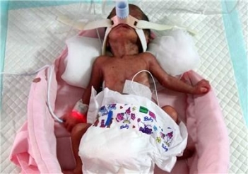 افزایش آمار نوزادان فوت شده کردستانی در سال جاری