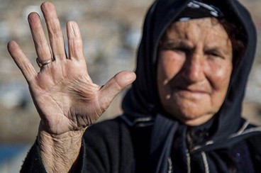 مردمی با انگشتان بریده در لرستان/ ماجرای تلخ سفر به قیمت قطع عضو