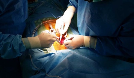 راه اندازی اولین مرکز جراحی محدود بانوان کشور در کاشان