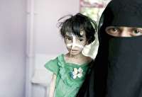 زنان و کودکان یمنی بی‌صدا می‌میرند