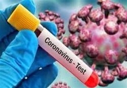 کیت تشخیص ویروس کرونا تولید بومی شد