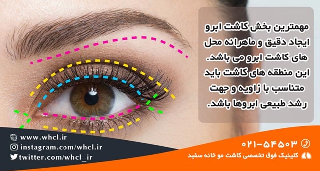 ریزش موی ابرو و درمان آن ریزش موی ابرو و درمان آن
