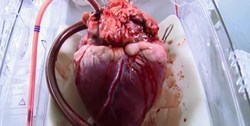 عملیات ویژه انتقال هوایی قلب اهدایی از تبریز به تهران با جت