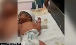 قطع انگشت یک نوزاد به‌علت سهل‌انگاری پرستار