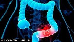 نقش رادیولوژی در تشخیص بیماری‌های گوارشی