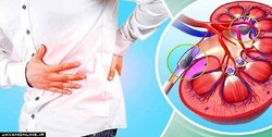بیماران «کلیوی» مواظب ابتلا به کرونا باشند