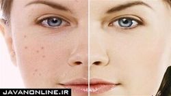 چگونه از طریق رنگ پوست می‌توان به نوع بیماری پی برد؟