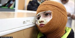 مصدومیت ۲۲۷ نفر بر اثر انفجار مواد محترقه/ سه نفر جان باختند