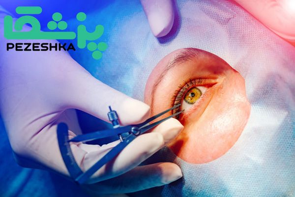 یک چشم پزشک خوب چه خصوصیاتی دارد؟ یک چشم پزشک خوب چه خصوصیاتی دارد؟