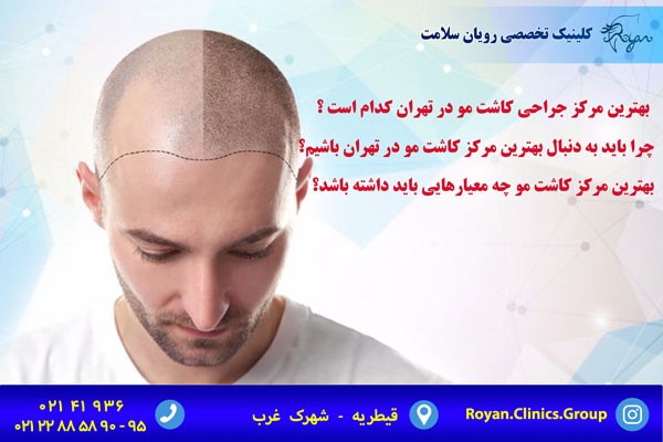 بهترین مرکز جراحی کاشت مو در تهران کدام است ؟
