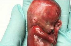 هویت کودک رها‌شده بی‌جان و مادرش در حومه اصفهان مشخص نیست