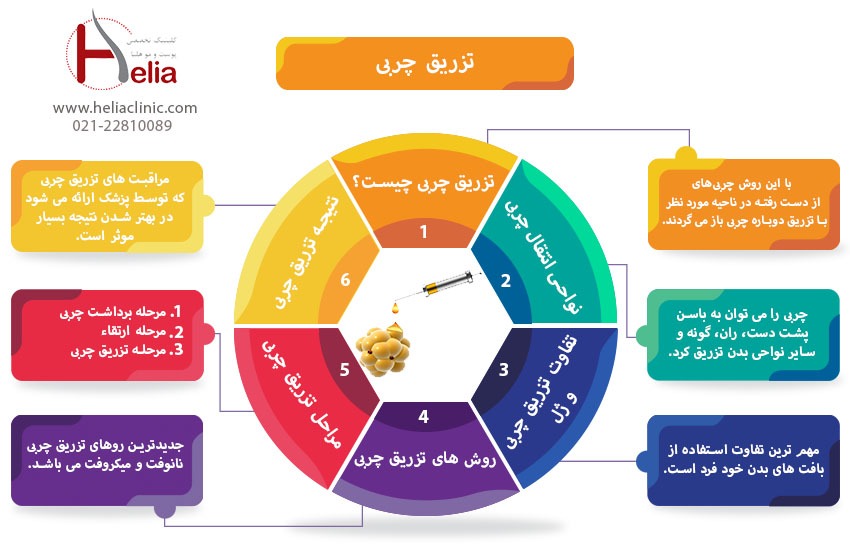 رپرتاژ هلیا-بهترین روش از بین بردن چین و چروک