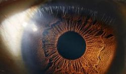 پیش بینی مرگ با غربالگری چشم‌ها