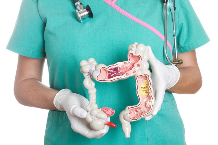 سرطان روده؛ یکی از شایع ترین مشکلات گوارشی سرطان روده؛ یکی از شایع ترین مشکلات گوارشی