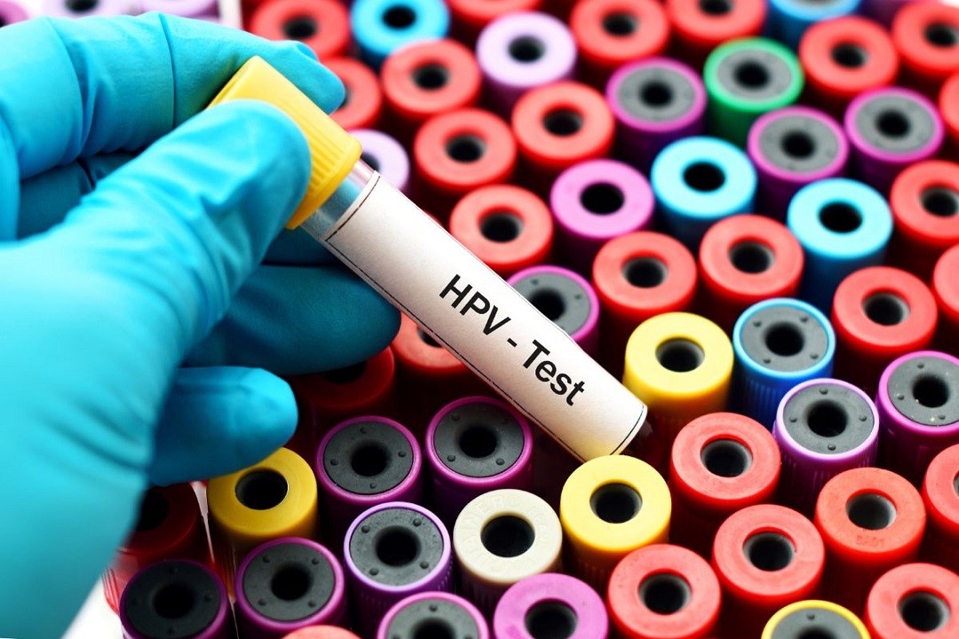 انواع ویروس پاپیلوما انسانی (HPV) انواع ویروس پاپیلوما انسانی (HPV)
