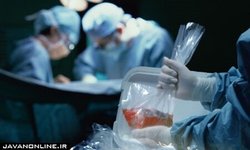 کاهش ۵۰ درصدی اهدای عضو با شیوع کرونا