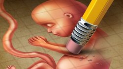 انجام روزانه ۷۵ سقط عمدی در خراسان رضوی