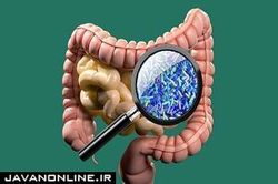 میکروب‌های روده بر شدت سکته مغزی تاثیر دارد
