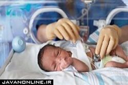 افزایش احتمال فلج مغزی با زایمان زودهنگام