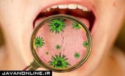 کرونا باعث بروز زخم در دهان و لثه‌ها می‌شود