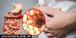 علائم گوارشی کرونا را بشناسید