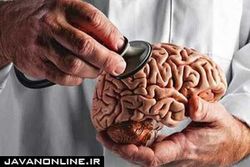 راهکار‌های طلایی برای سالم نگه داشتن مغز