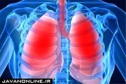 عوامل موثر در ایجاد سرطان ریه چیست؟