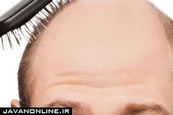 رژیم غذایی چرب چه بلایی سرتان می‌آورد