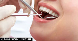 آثار مخرب سفید کردن دندان