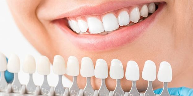 آیا از تاثیر زیبایی لمینت دندان بر چهره خود آگاهی دارید؟