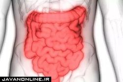استرس موجب تشدید چه نوع بیماری در بدن می‌شود؟