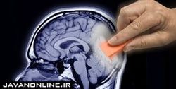 عامل ابتلا به آلزایمر پس از صدسال کشف شد