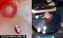 زنده نگه داشتن مغز انسان برای ۱۲ ساعت