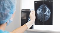 تشخیص فوری سرطان سینه با هوش مصنوعی