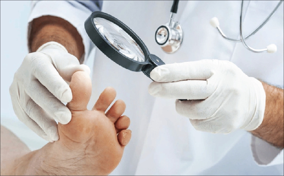 خداحافظی با قطع عضو دیابتی‌ها