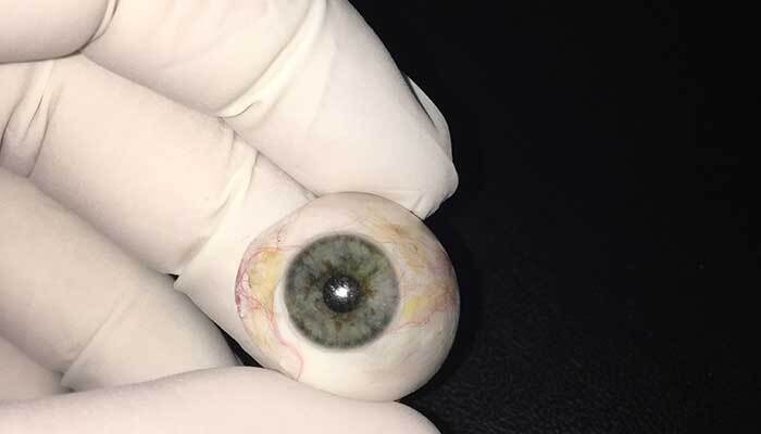 اولین روز با پروتز چشم، تجربه کاربران از نگاه اول در آینه