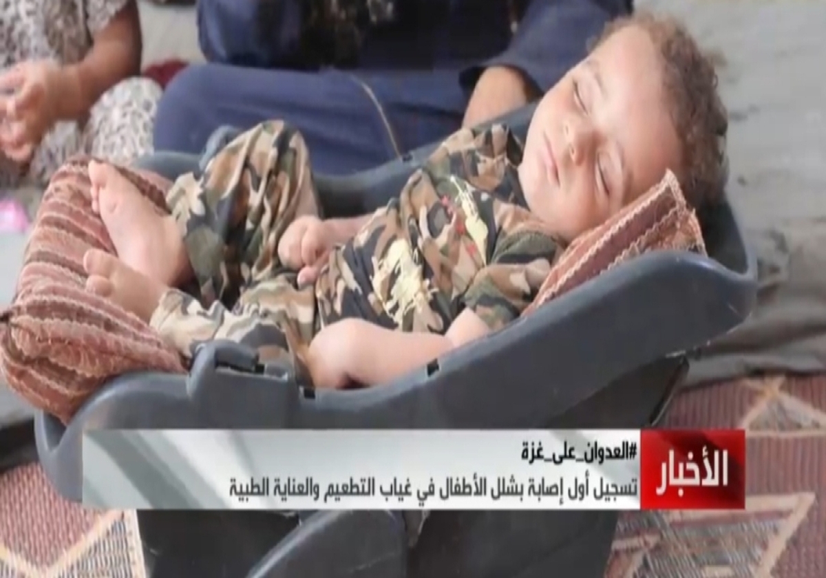 فلج اطفال در کمین کودکان غزه