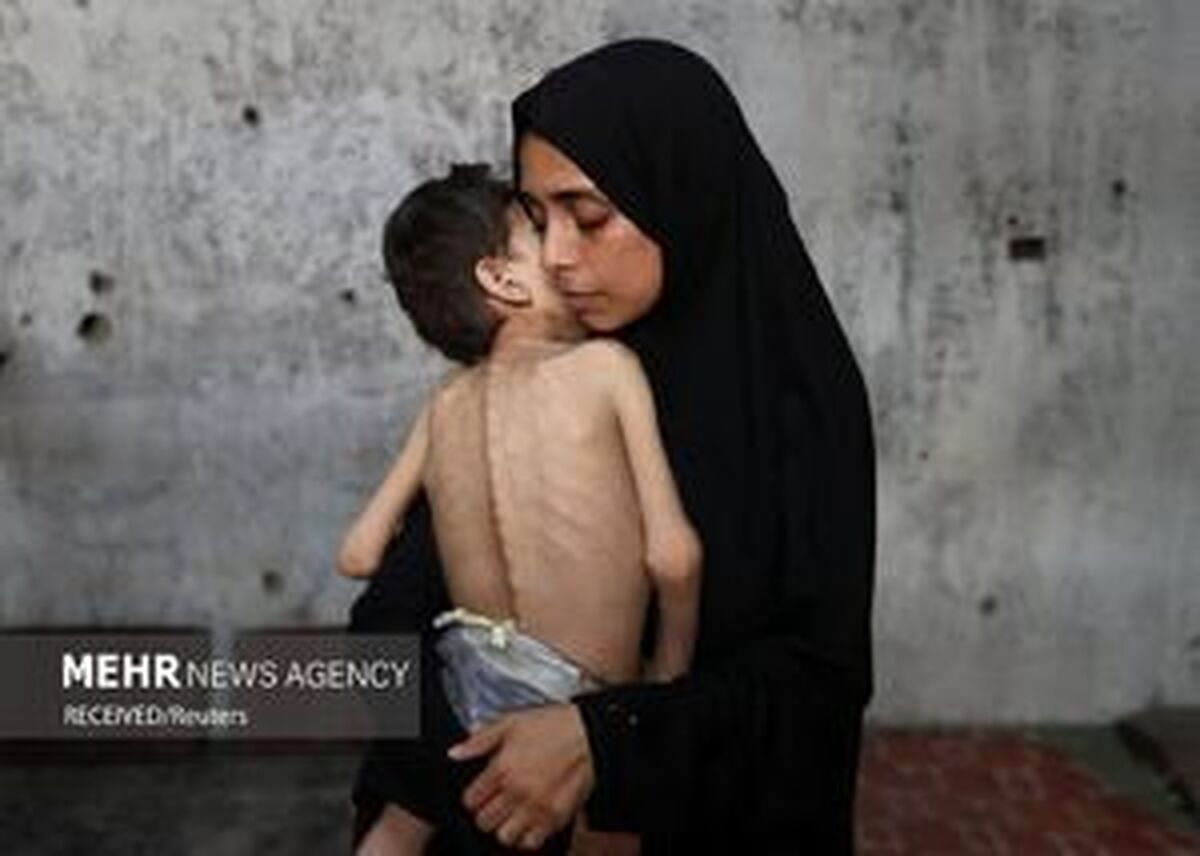 جان باختن ۵ نفر دیگر بر اثر گرسنگی در غزه