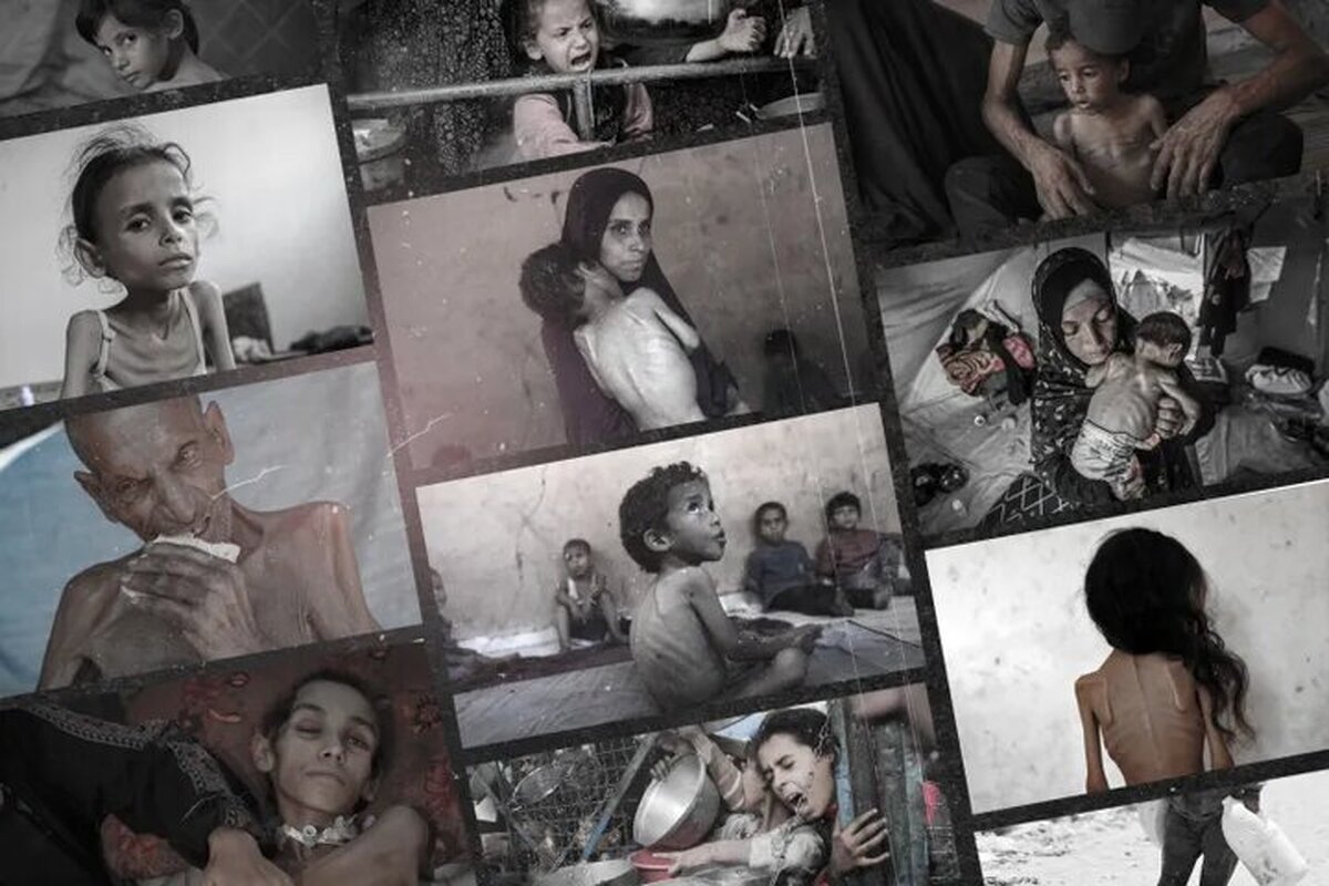 آمار شهدای قحطی در غزه طی ۲۴ ساعت ۲ رقمی شد