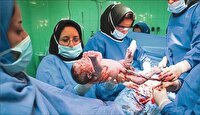 رشد آمار سزارین در سایه کمبود متخصص بیهوشی!