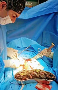 بیش از ۹۰ بسته مواد مخدر از معده و روده یک بیمار در کرج استخراج شد