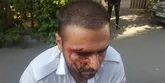 ضرب و شتم نیروی اورژانس تهران