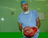 خروج غده 6 کیلویی از شکم زن بیمار در کنگان
