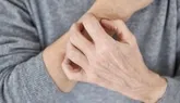 ۵ توصیه مهم برای مراقبت از پوست در سرما
